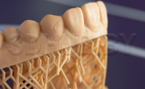 Модель из Dental Model Resin